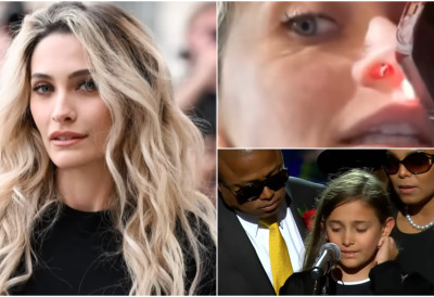 ЏЕКСОНОВА НАСЛЕДНИЦА ШОКИРАЛА ЈАВНОСТ УКАЗАВШИ НА ТРАГОВЕ ЗАВИСНОСТИ Парис показала нос с рупом услед губитка хрскавице