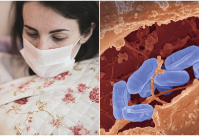 ЕВО У КАКВОМ ЈЕ СТАЊУ СТУДЕНТКИЊА ИЗ ИНДИЈЕ  КОЈОЈ СЕ РЕАКТИВИРАО ТИФУС У ФОЧИ Хитно оперисана, а доктор изнео све детаље