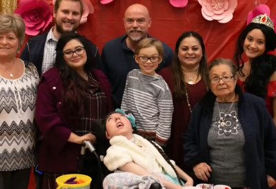 РОЂЕНА ГОТОВО БЕЗ МОЗГА, АЛИ ЈЕ ДЕМАНТОВАЛА МРАЧНЕ ПРОГНОЗЕ ЛЕКАРА Сада Алекс слави две деценије живота!