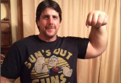 ЧОВЕК СА ЏИНОВСКИМ ШАКАМА, ШОКИРА СВЕТ И ЛЕКАРЕ! Рукума већим од кошаркашке лопте привлачи погледе, а своју НЕОБИЧНОСТ ПРЕТВОРИО је у спортски и животни успех