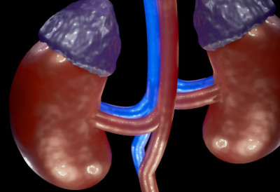 ОВА НАМИРНИЦА ИЗАЗИВА КАМЕН У БУБРЕГУ! Тешко ћете погодити шта је то што често једемо а може да направи велике невоље