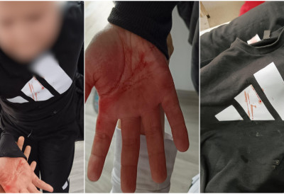 ГРОЗНО ВРШЊАЧКО НАСИЉЕ У ВЛАСОТИНЦУ Дечака ударали с леђа по глави У ШКОЛИ НЕ ПРИХВАТАЈУ ОДГОВОРНОСТ