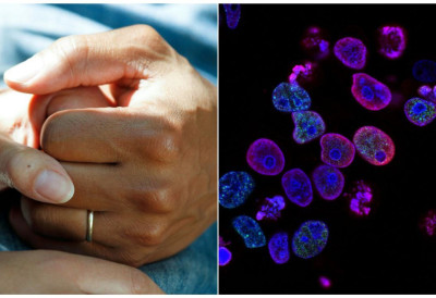 ЖЕНЕ НАЈЧЕШЋЕ ОД РАКА ДОЈКЕ ОБОЉЕВАЈУ У БАЧКОЈ И БАНАТУ Ово је мапа Србије са најмање и највише оболелих од карцинома!