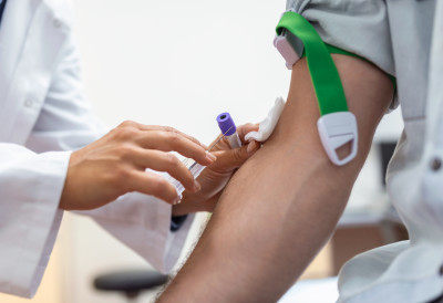 Вађење крви и пуцање вене ШЕСТ СИТУАЦИЈА У КОЈИМА НАСТАЈУ МОДРИЦЕ Ево када је неопходно да се јавите лекару