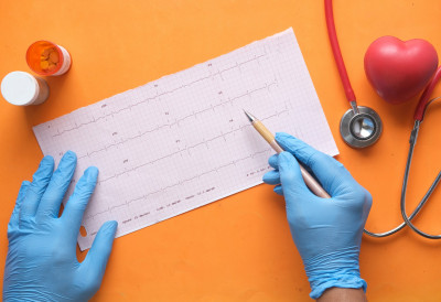 ТОКОМ ЗИМСКИХ ДАНА СВЕ ЈЕ ВИШЕ "СИНДРОМА ПРАЗНИЧНОГ СРЦа" Ево шта то подразумева и како се заштитити