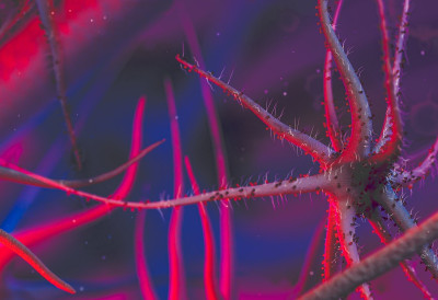 НА ДЕЦУ УДАРАЈУ УДРУЖЕНИ МУТИРАНИ ВИРУСИ, ПОЧИЊУ НАГЛО! Температура скаче и до 40, лечење се растегне и по месец дана!