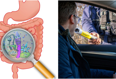 „ЈА ПИЈАН, А НИСАМ ПОПИО...” Може ли цревна флора да вас одбрани на суду? Да, ако имате синдром сопственог алкохолног врења