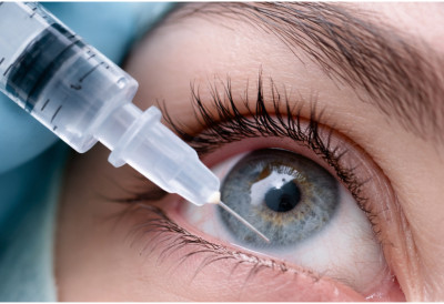 НОВА НАДА ЗА ХИЉАДЕ ЉУДИ КОЈИМА ПРЕТИ СЛЕПИЛО Почела примена иновативне терапије ГЕЛ ИНЈЕКЦИЈА У ОКО