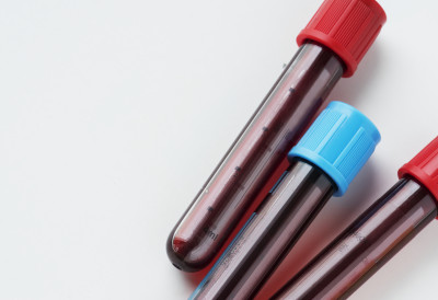 ПОРЕД ПУТА КОД ВРАЊА ПРОНАЂЕНО 300 ЕПРУВЕТА СА ТЕЧНОШЋУ ЗА КОЈУ СЕ СУМЊА ДА ЈЕ КРВ Покренута истрага, обавештено и надлежно министарство