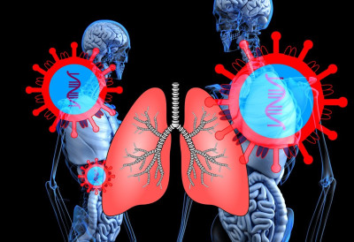 ДА ЛИ ЈЕ БРОНХИТИС, ИЛИ УПАЛА ПЛУЋА? Симптоми су слични, ЕВО по чему да их препознамо