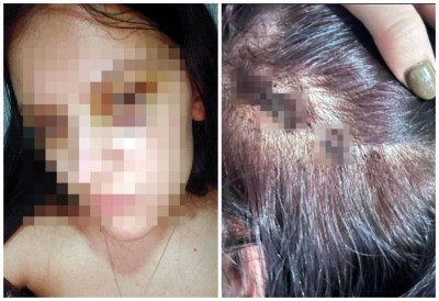 ОСУЂЕН СИЛЕЏИЈА ИЗ БЕРАНА ЗА СТРАВИЧНО ПРЕБИЈАЊЕ ДЕВОЈКЕ! Тукао је Дејану и док је лежала БЕЗ СВЕСТИ, она након пресуде: "Мислио је да ће се извући!"