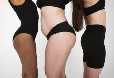 ОБЛИК ТЕЛА открива ко је у ризику од ДОБИЈАЊА КАНЦЕРА! Четири типа су издвојена, а научници упозоравају ко је у највећој опасности