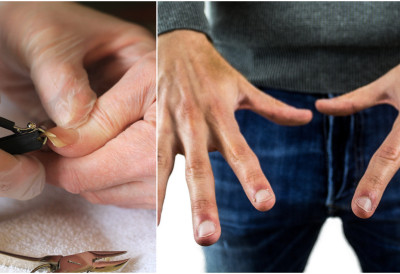 ЛИНИЈЕ НА НОКТИМА СУ ЈАСАН ЗНАК ПОРЕМЕЋАЈА Откривају шта вам недостаје у организму