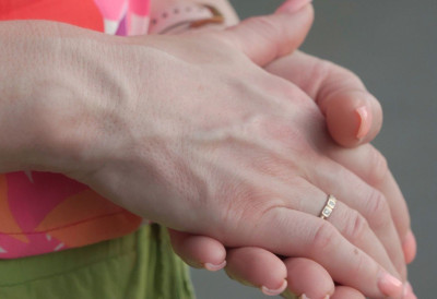 НА ШТА УКАЗУЈУ ИСПУПЧЕНЕ ВЕНЕ НА РУКАМА Нису безазлене, проузрокују озбиљне проблеме ЕВО КАДА ЈЕ ВРЕМЕ ЗА АЛАРМ