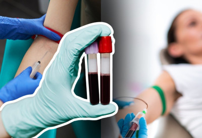 УКОЛИКО КРВНА СЛИКА ПОКАЗУЈЕ ОВЕ ВРЕДНОСТИ НИЈЕ ДОБРО! Ево како се правилно тумаче скраћенице на налазу ОВАЈ ДОМАЋИ ЕЛИКСИР ПОПРАВЉА ПАРАМЕТРЕ ОДМАХ (РЕЦЕПТ)