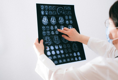 РЕКРЕАТИВНО УЗИМАЊЕ ДРОГА НОСИ ОЗБИЉНЕ ПОСЛЕДИЦЕ Наркотици разарају крвне судове и воде ка шлогу