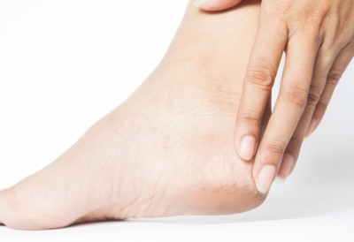 МУЧЕ ВАС ИСПУЦАЛЕ ПЕТЕ? Не морате код педикира! Постоје 4 јефтина и ЕФИКАСНА НАЧИНА да вратите глатку и здраву кожу