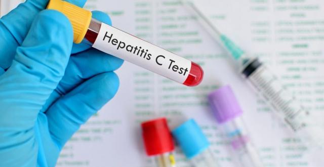 hepatitis c test, Ilustracija