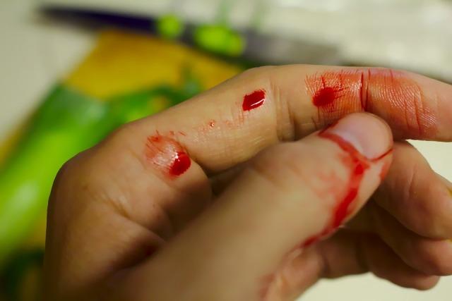 povreda krvarenje
