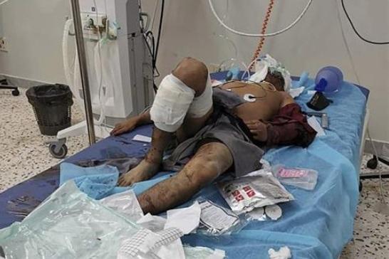 Stradali radnici u napadu na fabriku keksa u Tripoliju Foto: Center for Field Medicine and Support via AP